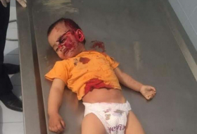 دليل على الأعمال الوحشية الأرمنية ضد الاطفال - صور