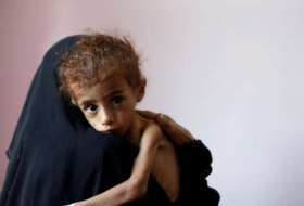 مسؤول أممي: اليمن على شفا كارثة والبشرية يجب أن تخجل من نفسها!
