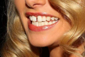 دراسة: أسنانك تكشف حالة 