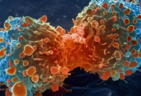 تصوير عمليات الآيض الخلوية قد يسهم في علاج السرطان