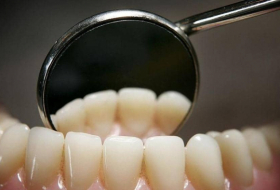 كيف تحمي أسنانك من التسوس؟.. 8 نصائح ذهبية