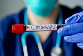    أذربيجان:   تسجيل 203 حالة جديدة للاصابة بفيروس كورونا المستجد     