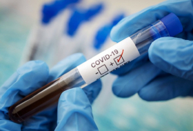  ستوفر الحكومة الهولندية اختبارات فيروسات التاجية مجانية لكل من يرغب 