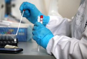   أذربيجان:  1068 إصابة بكورونا وتطعيم 8471 جرعة من لقاح كورونا في 21 يناير 